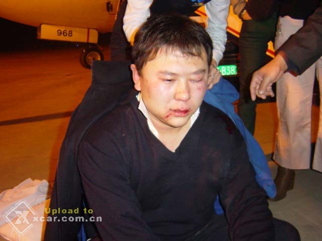 （转贴）身边的黑暗啊！临沂全国人大代表王庭江机场带领一群人打安全员！